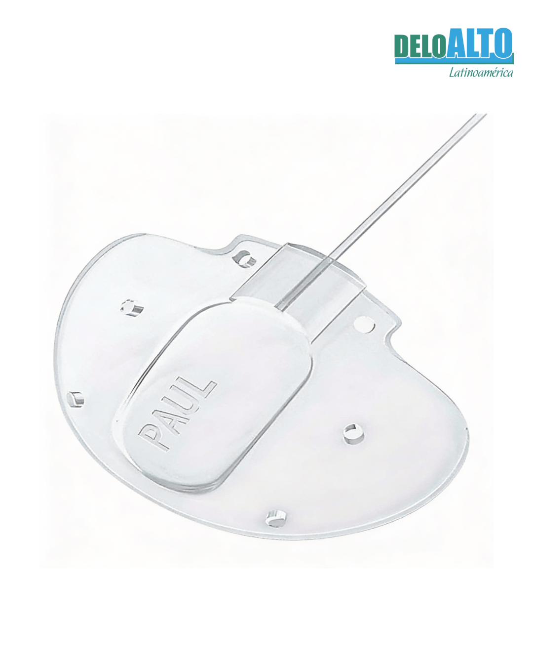 Implante de Glaucoma PAUL– Dispositivo de Drenaje de Nueva Generación con Tecnología de Microtúbulo